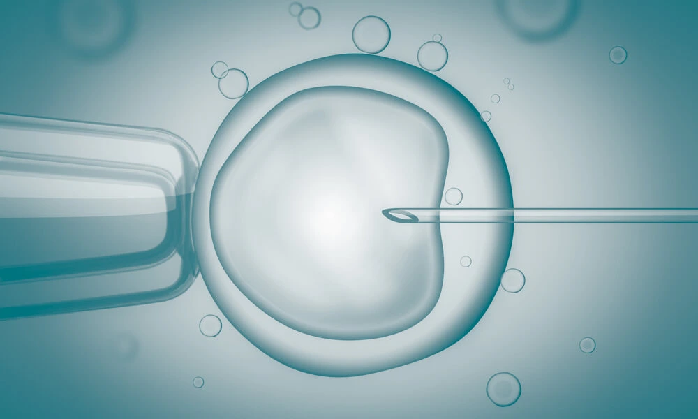 First IVF Treatment 1978